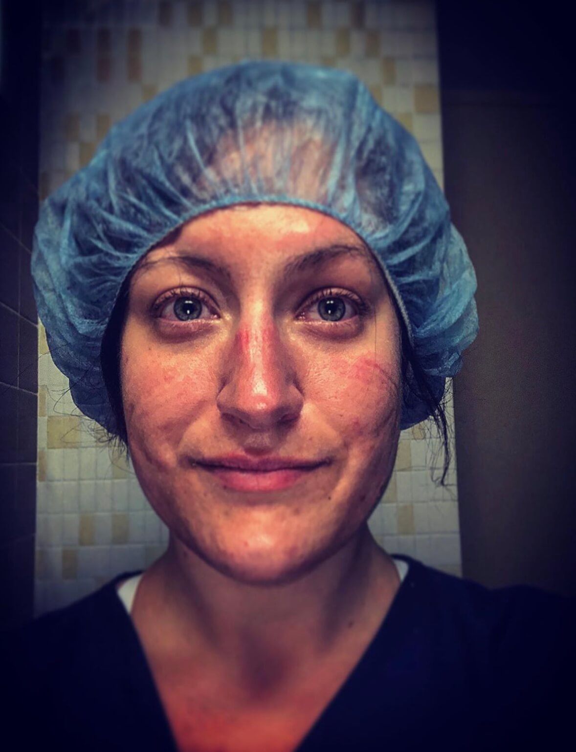 Ashley Caretto, a Med-Surg RN, in surgical cap Ashley Caretto, a Med-Surg RN, in surgical cap
