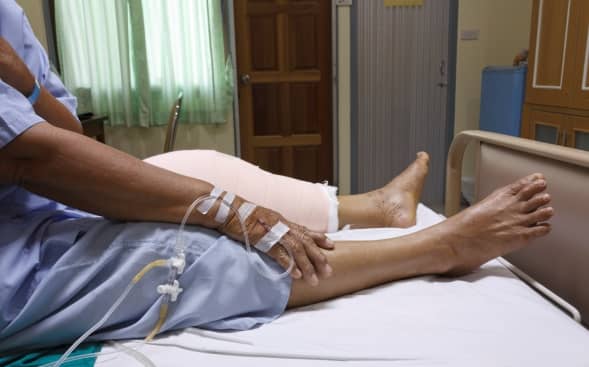 Knee Replacement Knee Replacement
