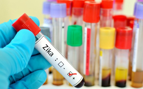 zika virus zika virus
